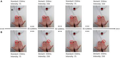 The effect of neural pre-stimulus oscillations on post-stimulus somatosensory event-related potentials in disorders of consciousness